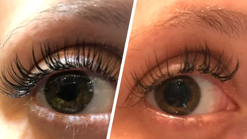 can lash extensions make your lashes fall out